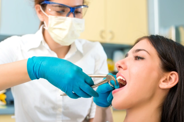 Tooth Extractions