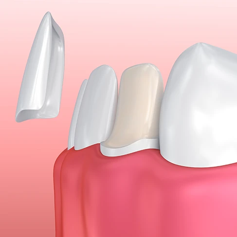 teeth protector cover