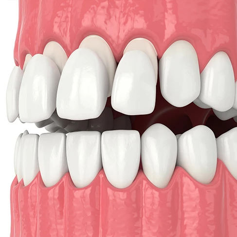 fixing teeth at Brookline Smile Artists