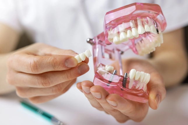 Long-Term Follow-Up and Maintenance