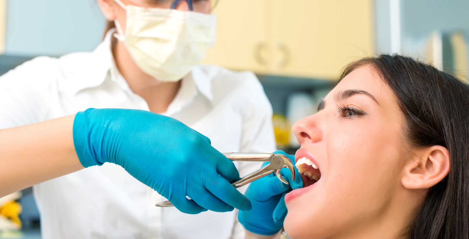 Top Reasons a Tooth Must Be Extracted