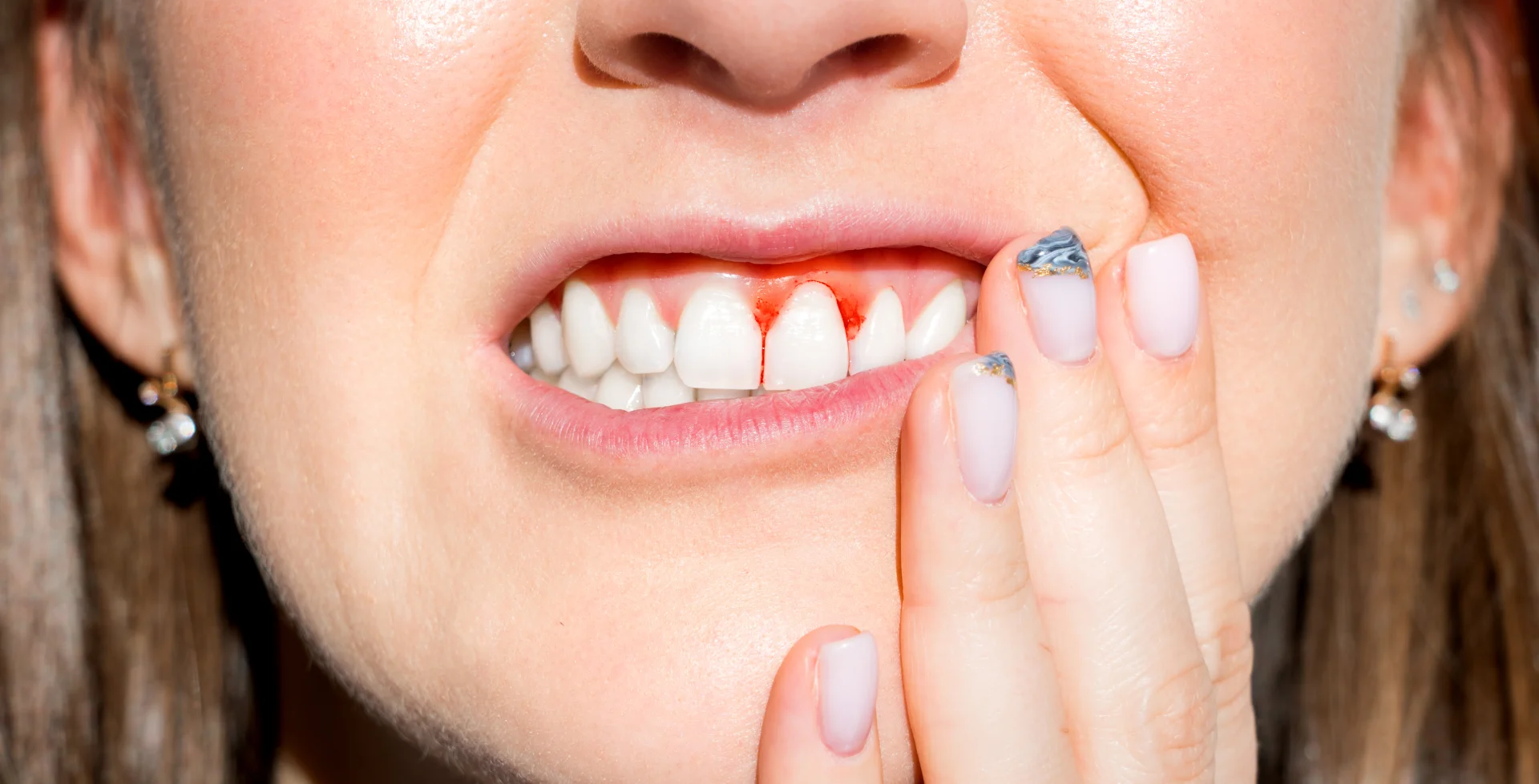 What Happens If You Ignore Gingivitis_ (1)