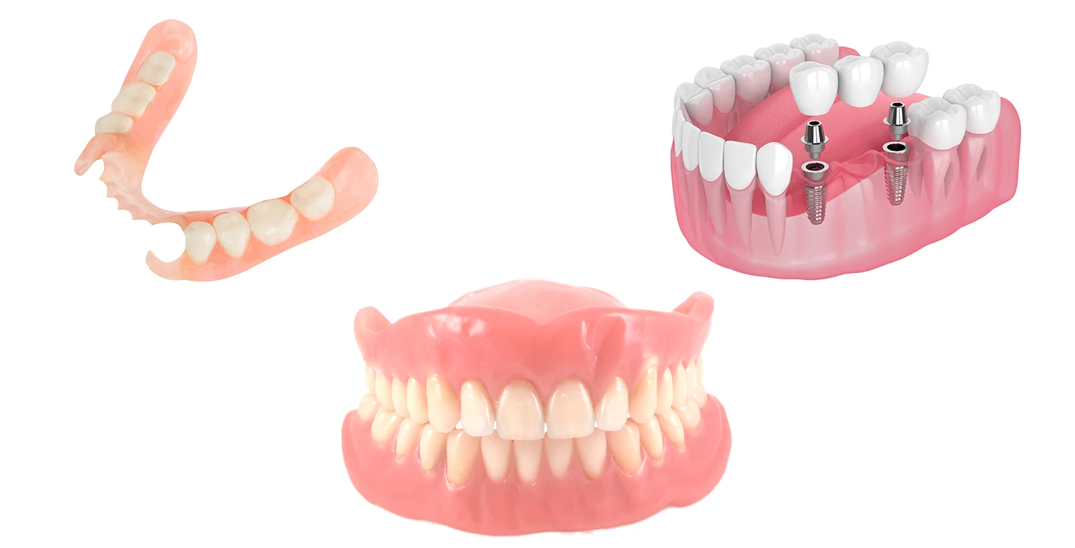 three types of dentures